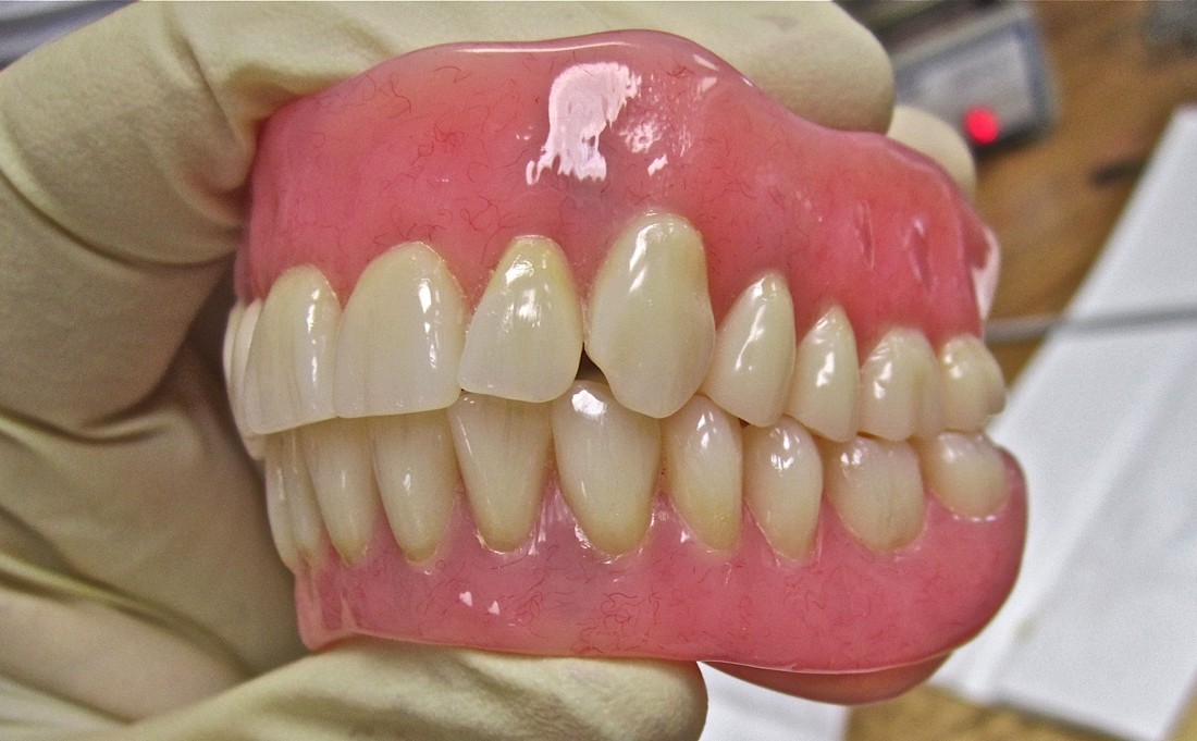Complete or Partial Dentures - Thunder Bay Dental Center ... diagram of snoring 